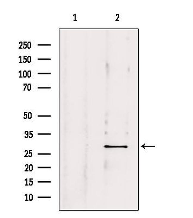 OTUB2 Antibody in Western Blot (WB)