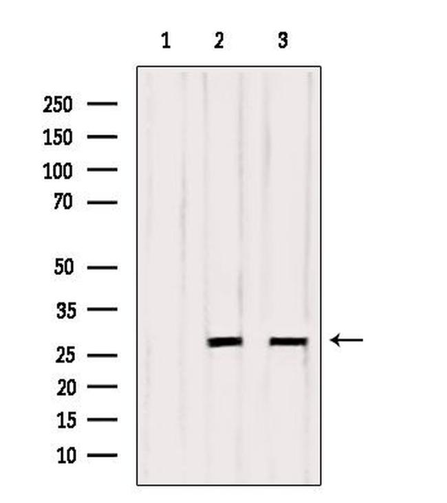 OTUB2 Antibody in Western Blot (WB)