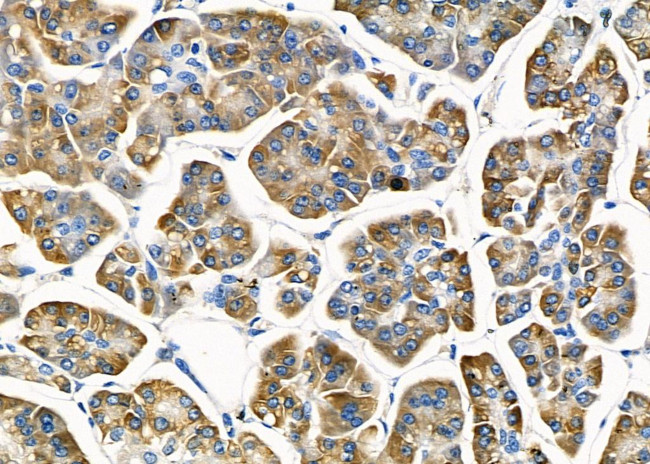 RPS2 Antibody in Immunohistochemistry (Paraffin) (IHC (P))