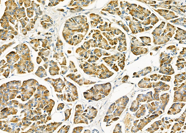 RPS2 Antibody in Immunohistochemistry (Paraffin) (IHC (P))