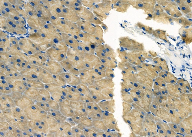 RPS2 Antibody in Immunohistochemistry (Paraffin) (IHC (P))