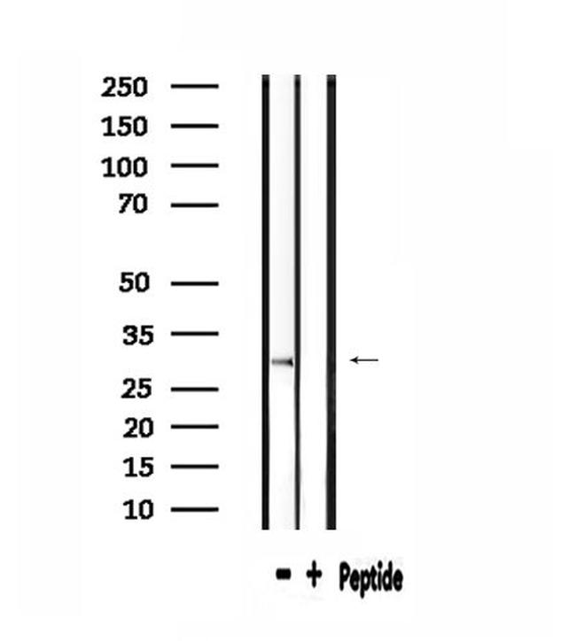 RPS2 Antibody in Western Blot (WB)