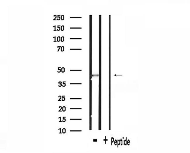 SS18 Antibody in Western Blot (WB)