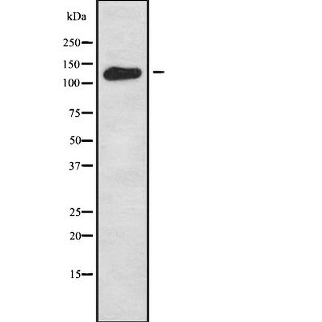 WDHD1 Antibody in Western Blot (WB)