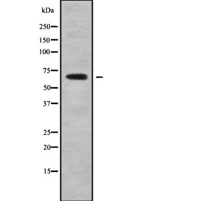 MAGED2 Antibody in Western Blot (WB)