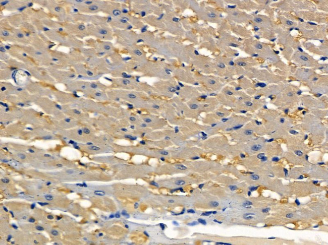 IFNLR1 Antibody in Immunohistochemistry (Paraffin) (IHC (P))