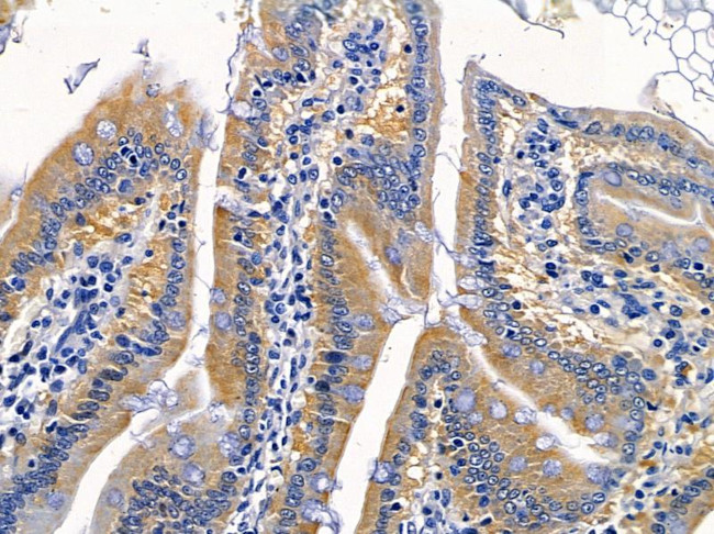 IFNLR1 Antibody in Immunohistochemistry (Paraffin) (IHC (P))