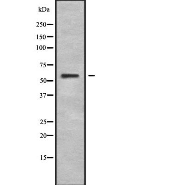 IFNLR1 Antibody in Western Blot (WB)