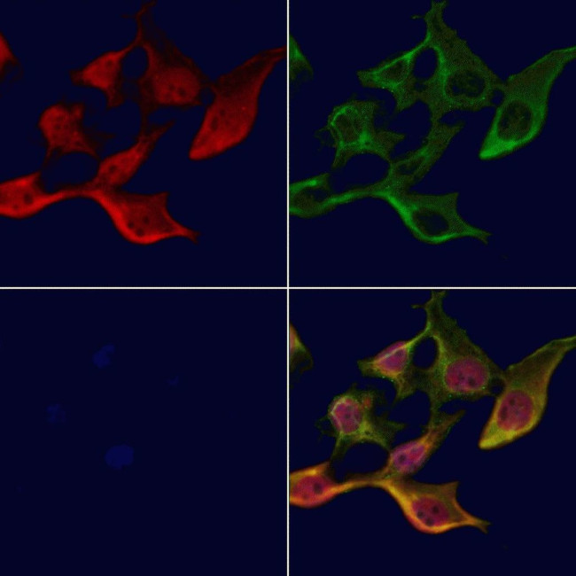 TXK Antibody in Immunocytochemistry (ICC/IF)