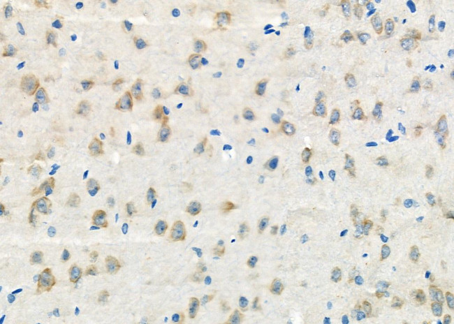 TXK Antibody in Immunohistochemistry (Paraffin) (IHC (P))