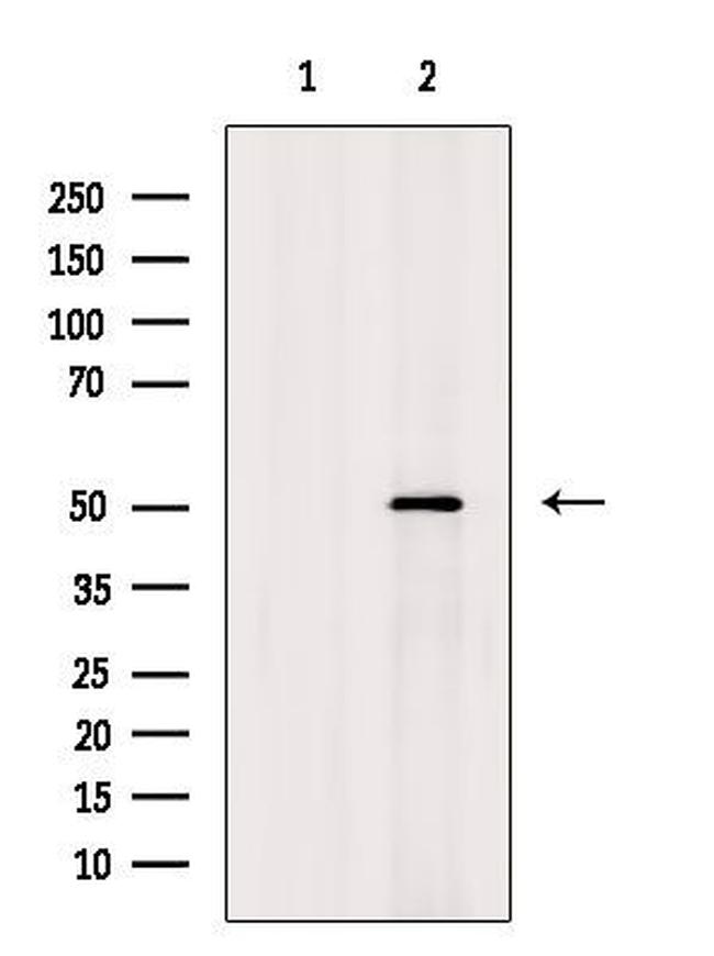 ENOSF1 Antibody in Western Blot (WB)