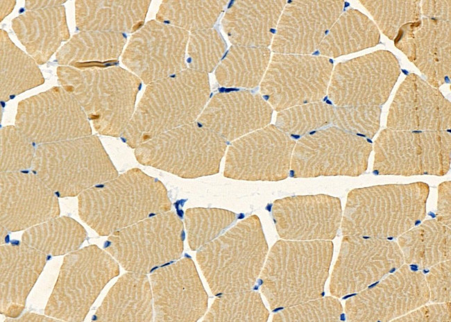 CELSR1 Antibody in Immunohistochemistry (Paraffin) (IHC (P))