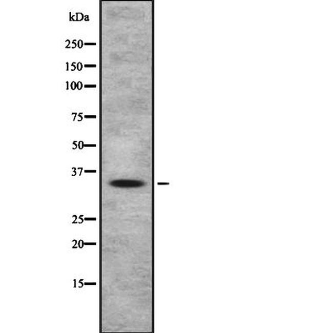 OR4A47 Antibody in Western Blot (WB)