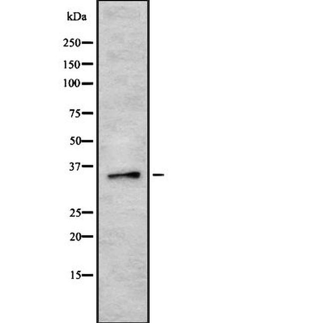 HCG39951 Antibody in Western Blot (WB)