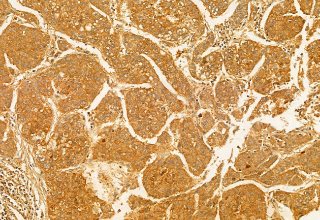 FIP200 Antibody in Immunohistochemistry (Paraffin) (IHC (P))