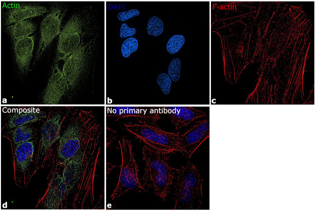 Actin Antibody in Immunocytochemistry (ICC/IF)