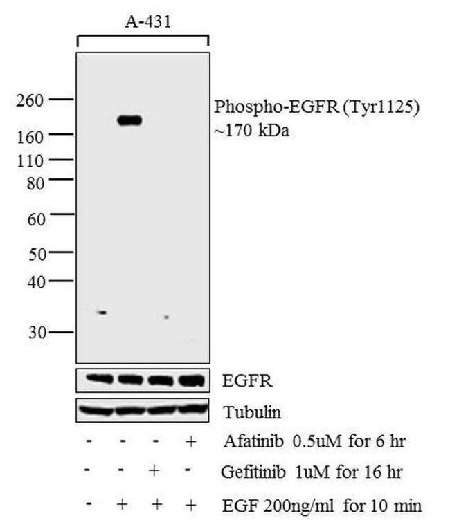 Phospho-EGFR (Tyr1125) Antibody in Western Blot (WB)