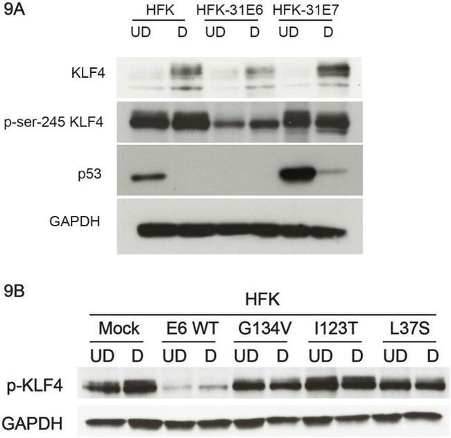 Phospho-KLF4 (Ser245) Antibody in Western Blot (WB)