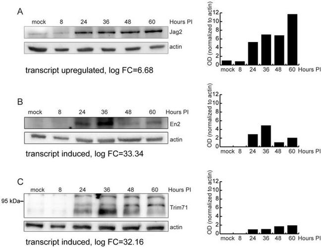 TRIM71 Antibody in Western Blot (WB)