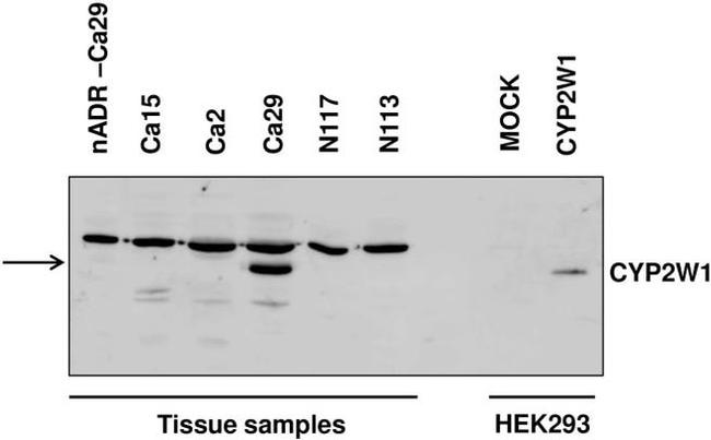 CYP2W1 Antibody in Western Blot (WB)