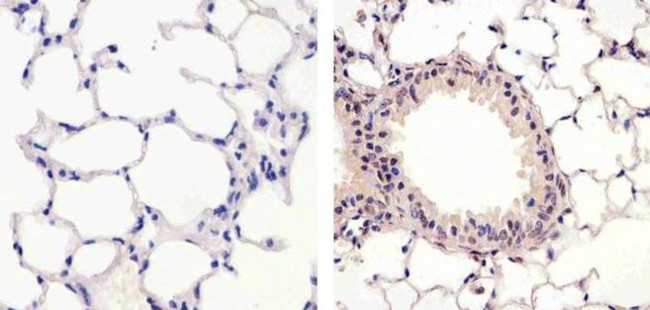 MEK1 Antibody in Immunohistochemistry (Paraffin) (IHC (P))