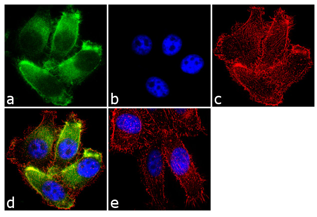 MMP13 Antibody in Immunocytochemistry (ICC/IF)