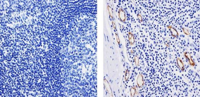 VWF Antibody in Immunohistochemistry (Paraffin) (IHC (P))