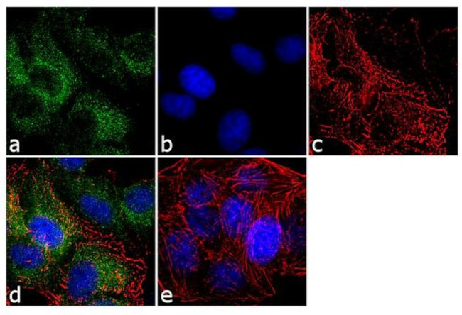 MMP9 Antibody in Immunocytochemistry (ICC/IF)