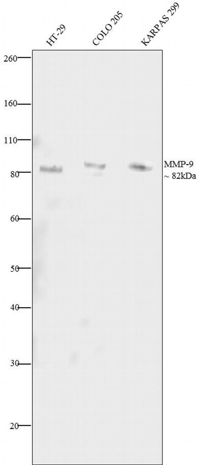 MMP9 Antibody in Western Blot (WB)