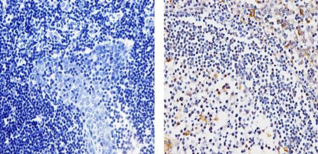 MMP9 Antibody in Immunohistochemistry (Paraffin) (IHC (P))