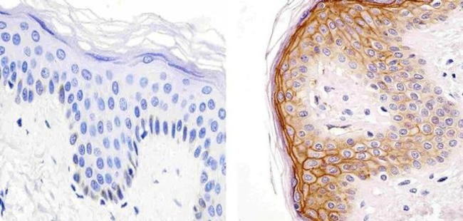 CD138 Antibody in Immunohistochemistry (Paraffin) (IHC (P))