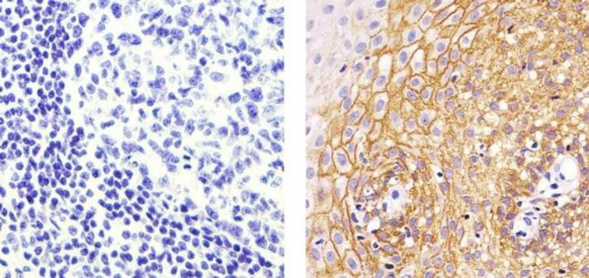 CD138 Antibody in Immunohistochemistry (Paraffin) (IHC (P))