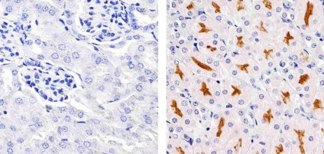 CD138 Antibody in Immunohistochemistry (Paraffin) (IHC (P))