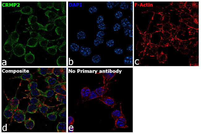 CRMP2 Antibody in Immunocytochemistry (ICC/IF)