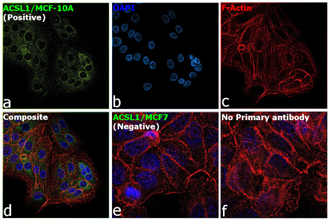 ACSL1 Antibody