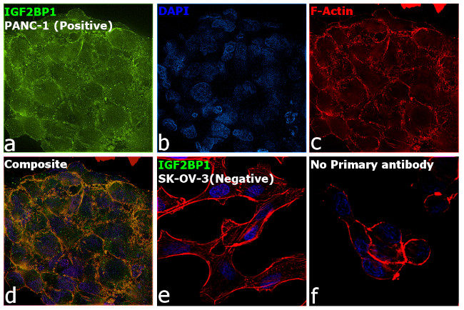 IGF2BP1 Antibody in Immunocytochemistry (ICC/IF)