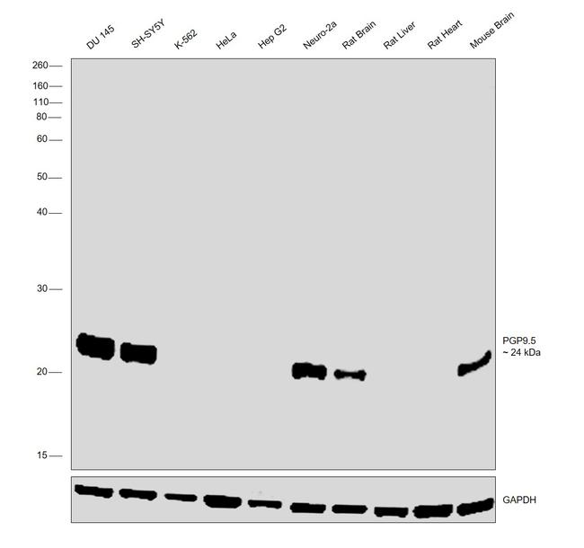 PGP9.5 Antibody in Western Blot (WB)