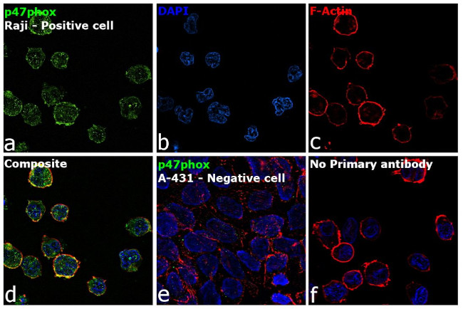 p47phox Antibody in Immunocytochemistry (ICC/IF)