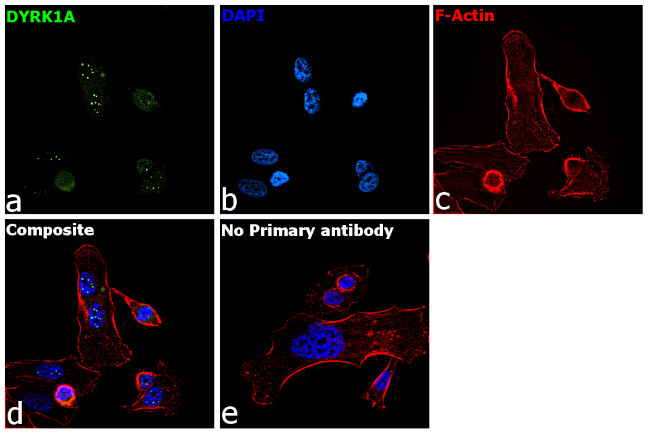 DYRK1A Antibody in Immunocytochemistry (ICC/IF)
