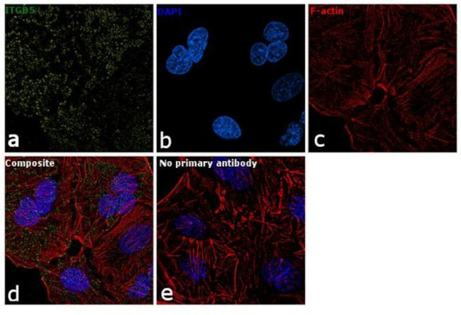 ITGB5 Antibody in Immunocytochemistry (ICC/IF)