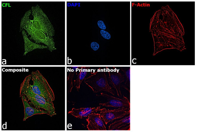 Cofilin Antibody in Immunocytochemistry (ICC/IF)