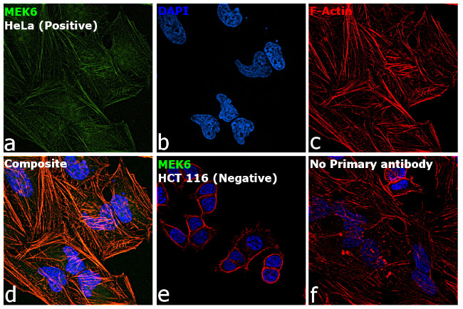 MEK6 Antibody in Immunocytochemistry (ICC/IF)