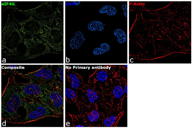 eIF4G Antibody in Immunocytochemistry (ICC/IF)