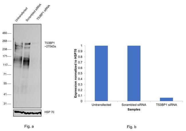 53BP1 Antibody in Western Blot (WB)