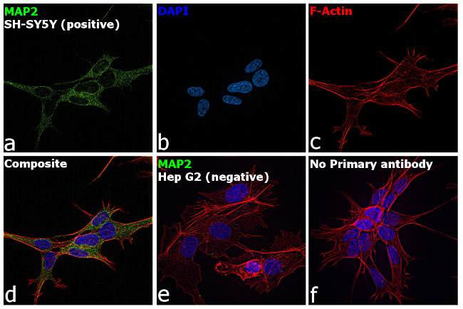 MAP2 Antibody in Immunocytochemistry (ICC/IF)