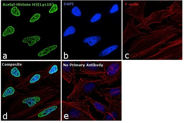 H3K18ac Antibody in Immunocytochemistry (ICC/IF)