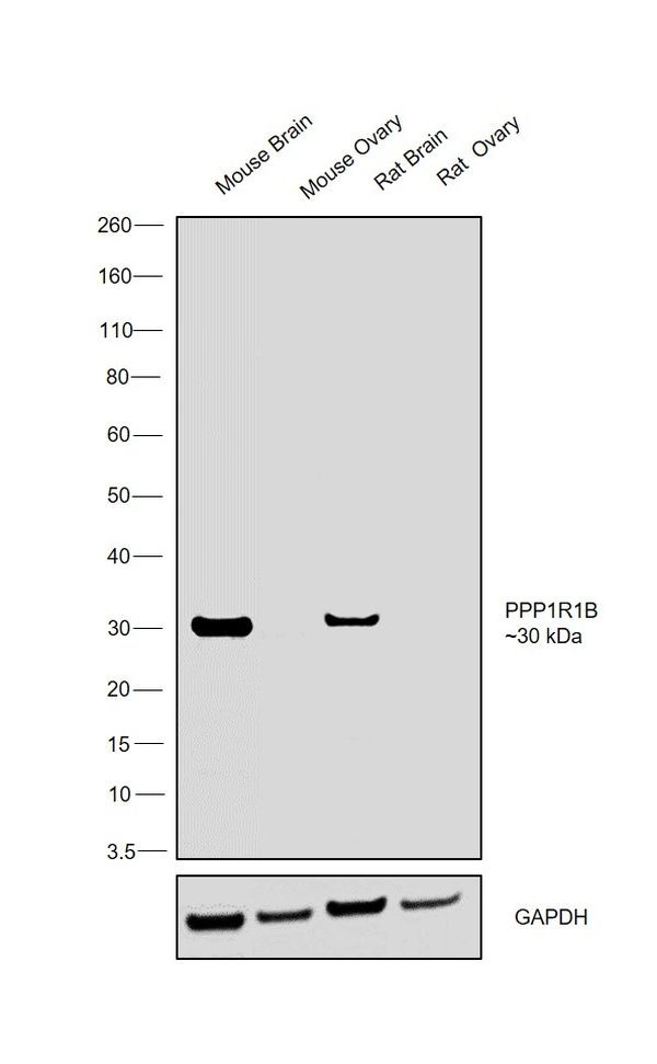 DARPP-32 Antibody