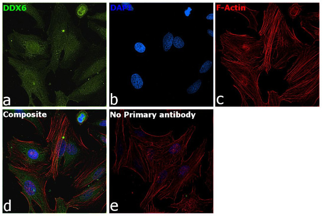 DDX6 Antibody in Immunocytochemistry (ICC/IF)