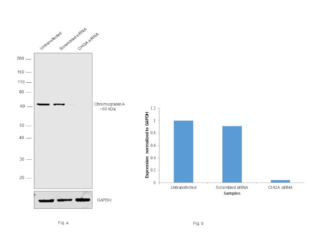 Chromogranin A Precursor Antibody