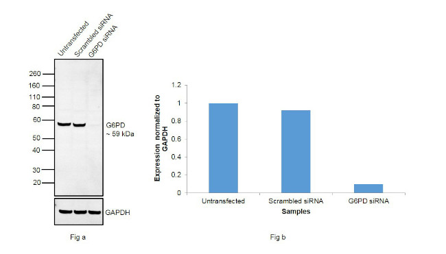 G6PD Antibody